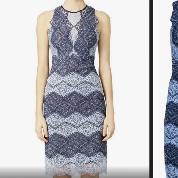 Erin Featherston Lace Dress - Picture 1 of 8